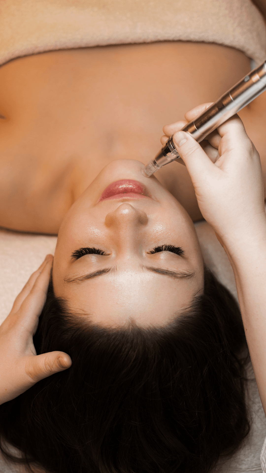 Microneedling